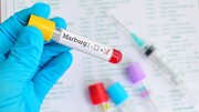 ویروس جدید «ماربورگ» چیست؟ + علائم، نحوه انتقال و درمان