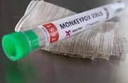ایران واکسن آبله میمونی می‌خرد / واکسیناسیون علیه آبله میمونی عمومی خواهد شد؟