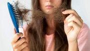 درمان فوری و قطعی ریزش مو با چند ترفند ساده و کاربردی و خانگی بدون هزینه