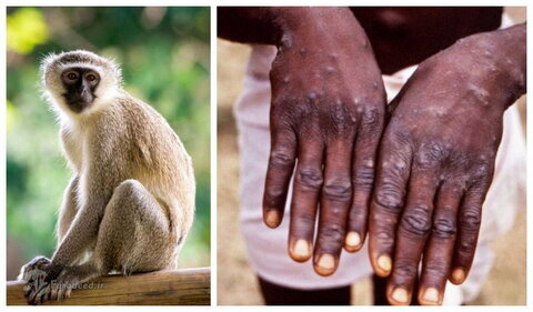 افزایش آمار مبتلایان آبله میمونی در سراسر دنیا