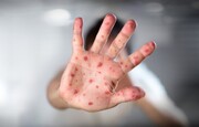 نشانه‌های ابتلا به آنفولانزای گوجه‌فرنگی / این ویروس چقدر خطرناک است؟