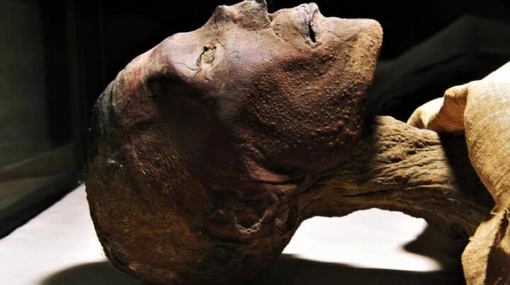 یافته های عجیب دانشمندان: فرعون مصر به آبله میمون مبتلا بوده است