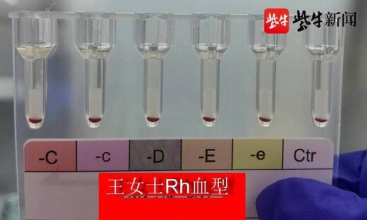 کشف گروه خون طلایی در چین!