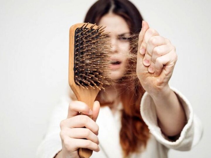 تاثیر کبد چرب بر افزایش ریزش مو 