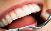 چند درمان طبیعی برای داشتن دهانی خوشبو