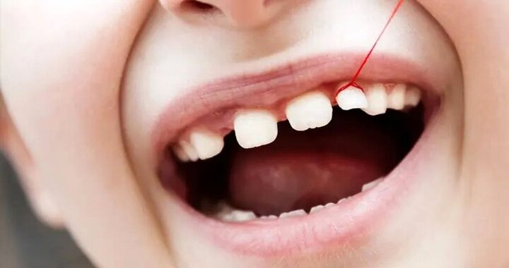  داروهایی که باعث پوسیدگی دندان می شوند
