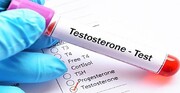 علائم تستوسترون پایین در مردان چیست؟
