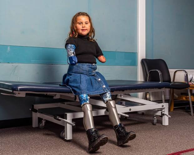 تصاویر جوان‌ترین دختر جهان که زانوی رباتیک دارد