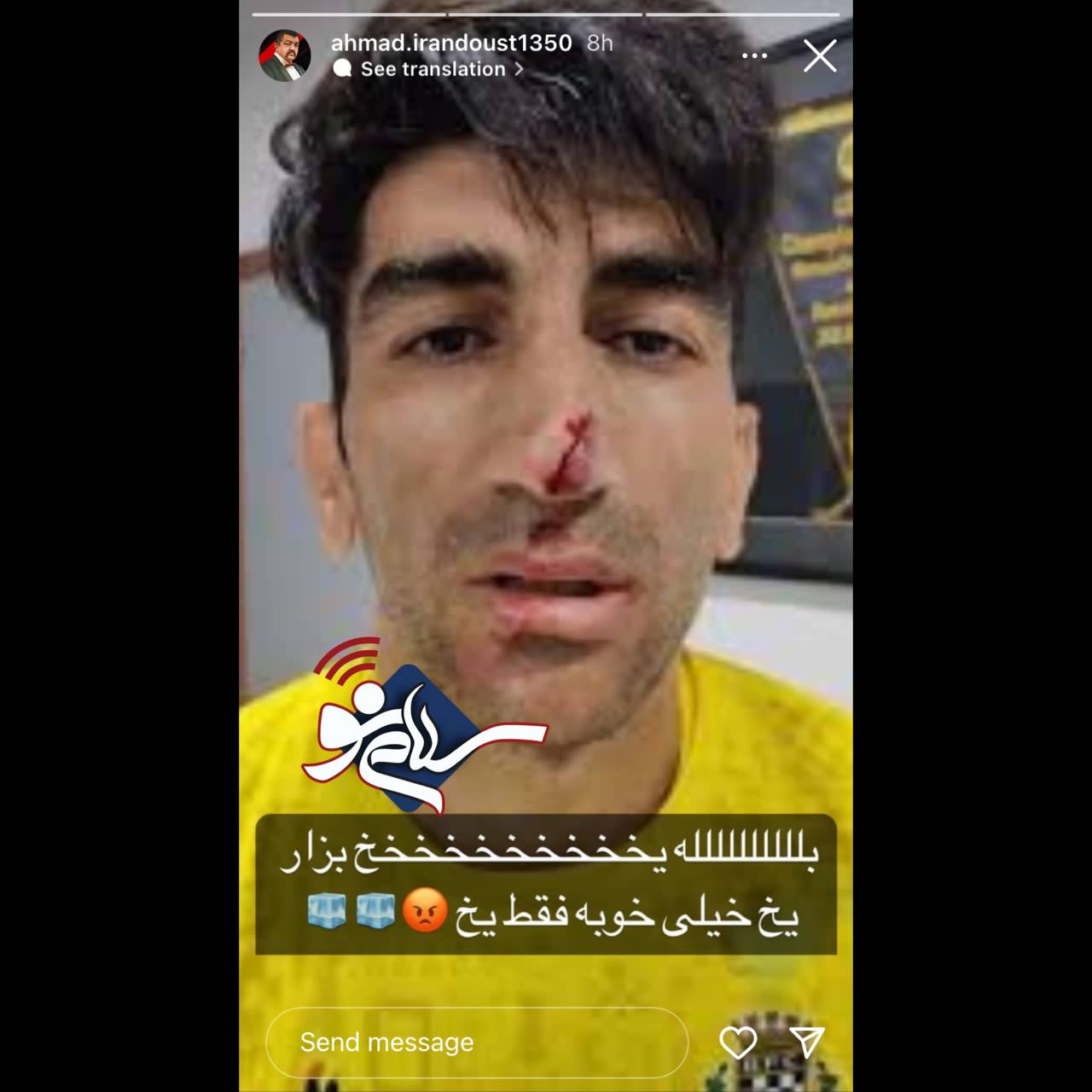 کنایه معنادار غول برره به مصدومیت علیرضا بیرانوند + عکس