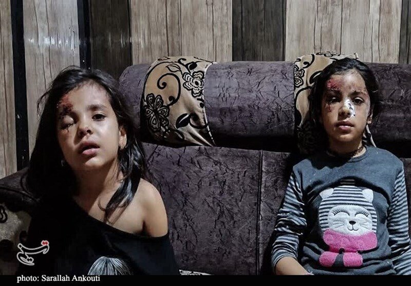 تصویر | حمله سگ‌های ولگرد به ۲ دختربچه در کرمان | عکس آیدا و آیسای زخمی را ببینید