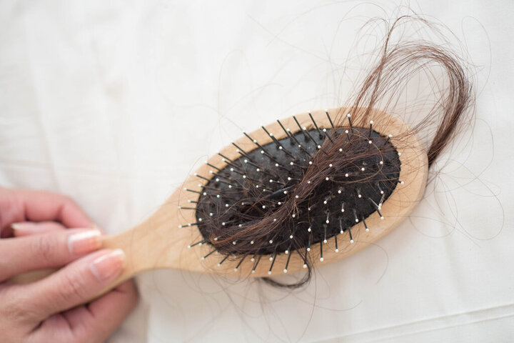 علت ریزش مو در زنان و جلوگیری از آن