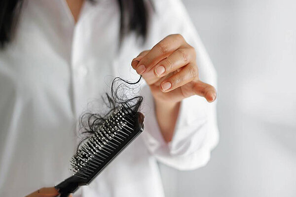دلایل ریزش مو در زنان | مهمترین علت ریزش مو را بشناسید | برای جلوگیری از ریزش مو چه بخوریم؟