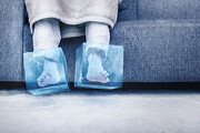 علت متورم شدن پاها در فصل سرما چیست؟