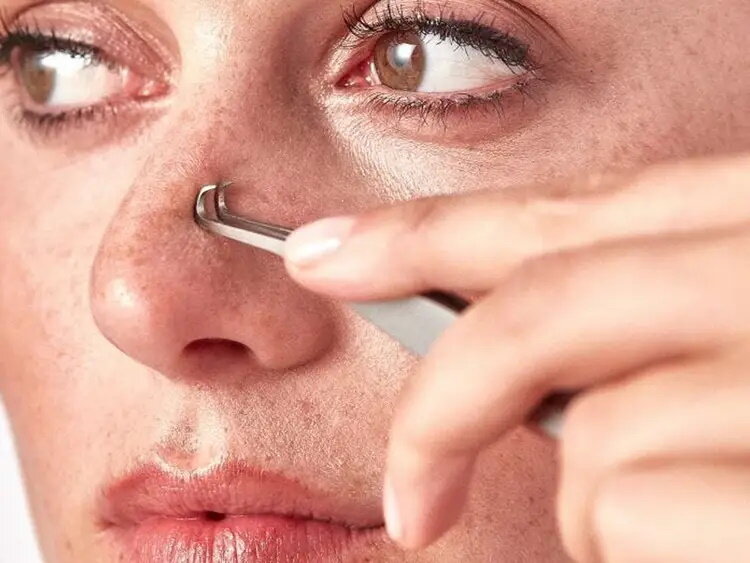 ترفند خلاصشدن از شر جوشهای سرسیاه