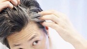 ۵ علت اصلی سفید شدن موی سر