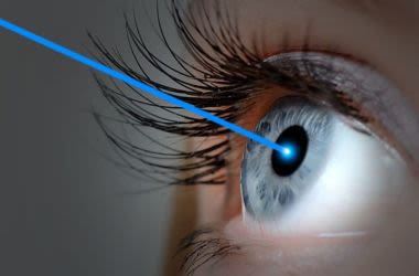 همه چیز در مورد عمل لیزیک چشم  + مزایا و عوارض لیزیک چشم + بهترین چشم پزشکی تهران 