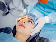 همه چیز در مورد عمل لیزیک چشم  + مزایا و عوارض لیزیک چشم + بهترین چشم پزشکی تهران