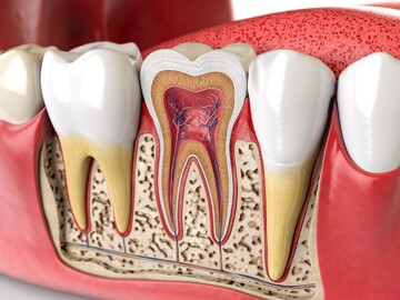 چرا موفقیت عصب کشی مجدد قطعی نیست؟