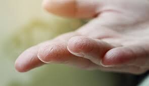 چند راهکار خانگی برای رفع خشکی پوست دست