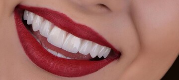 بهترین دندانپزشک‌های زیبایی در تهران