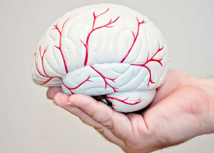 چرا انسانها سکته مغزی می کنند؟ + عکس