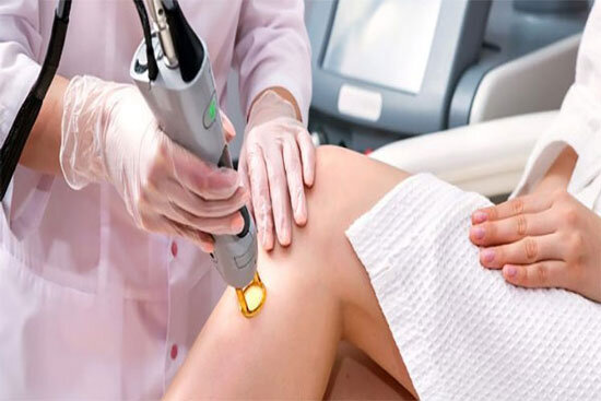 بهترین دستگاه لیزر کدام است؟