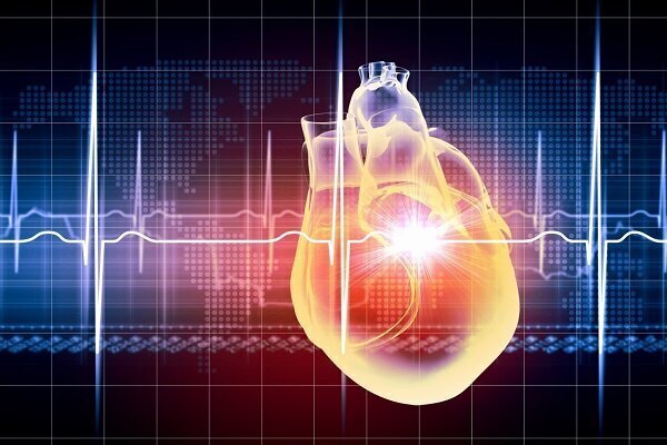 سکته قلبی چیست؟ + علائم و نشانه ها | هنگام سکته قلبی چه کار کنیم؟
