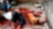 ویدیو دلخراش از حمله هولناک سگ وحشی به یک مرد جوان