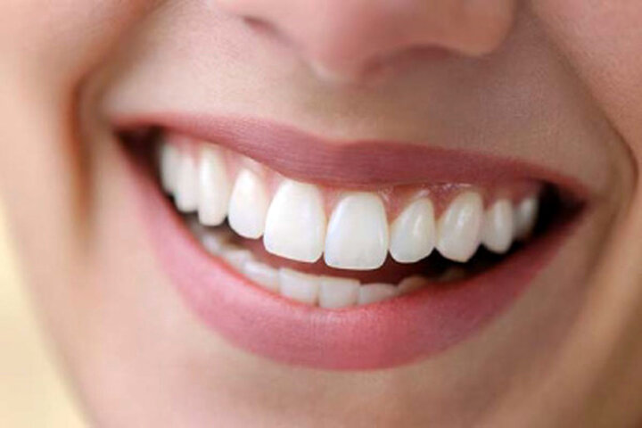 چه کار کنیم تا دندان ما سفید شود؟ + چند ترفند ساده و خانگی ارزان