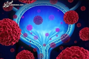 کشف جدید دانشمندان: کرونا انواع مختلف سرطان را درمان می‌کند