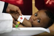 وضعیت وخیم ۱۱ میلیون کودک در یمن/ هر ۱۰ دقیقه یک کودک می میرد