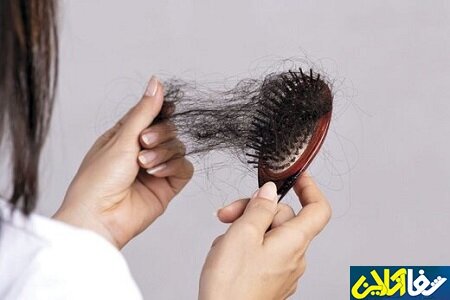 دلیل ریزش مو چیست و علائم و نشانه های آن کدام است؟ + پیشگیری و درمان ریزش مو
