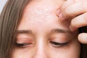 ۴ توصیه مهم برای کسانی که پوستی خشک دارند