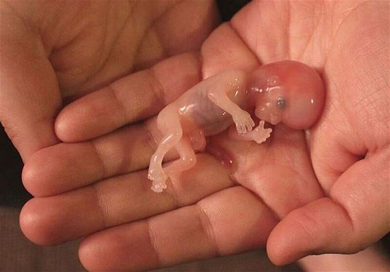 ساخت جنین مصنوعی انسان غوغا به پا کرد! + عکس عجیب