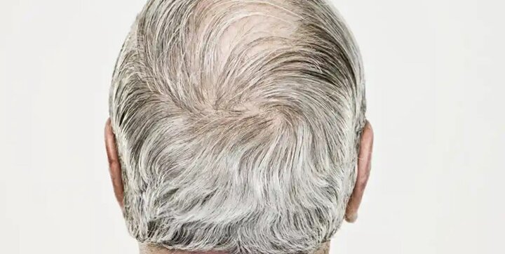 کشف دانشمندان درباره امکان سیاه‌کردن موی سفید