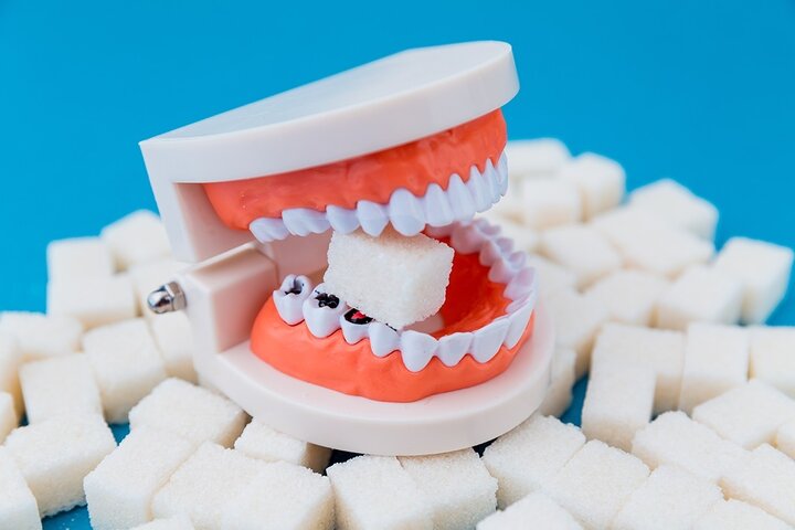  مواد قندی چه بلایی سر دندان می آورد؟