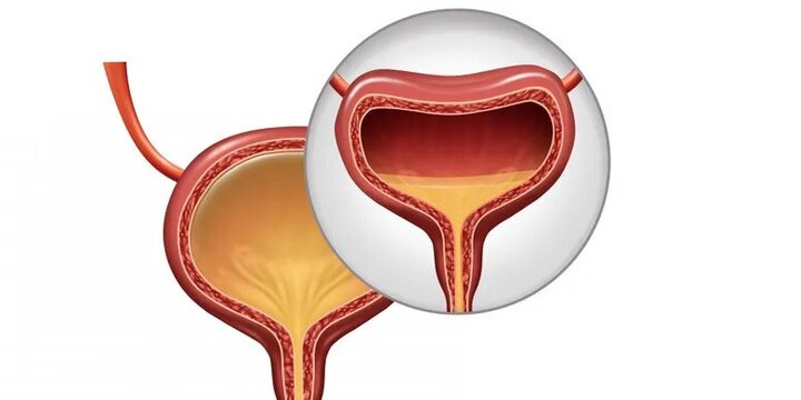 عوارض وحشتناک نگه داشتن ادرار