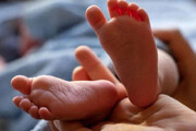 به دنیا آمدن نوزاد سه دست در هند + فیلم
