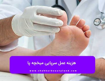 هزینه عمل سرپایی میخچه پا