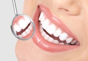 سفید کردن دندان ها در خانه با چند روش متفاوت