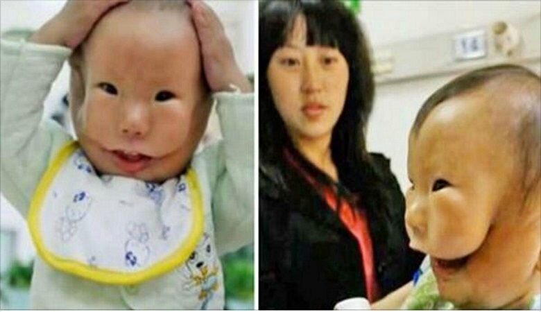 کودک ژاپنی با دو چهره