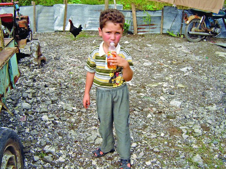 این پسر بچه ایرانی هرروز نیم لیتر بنزین می‌خورد! / تصاویر