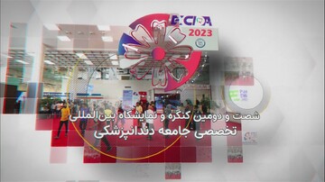 اکسیدا ۲۰۳۳؛ مهم‌ترین کنگره دندانپزشکی ایران چه دست آوردی داشت؟