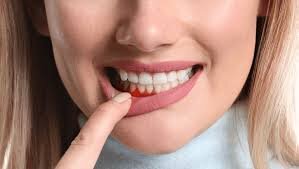 ژاپنی‌ها حدیث پیامبر اسلام را ثابت کردند / بهداشت دهان به حافظه کمک می‌کند!