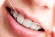 ۶ عادت روزانه که باعث زرد شدن دندان ها می شود