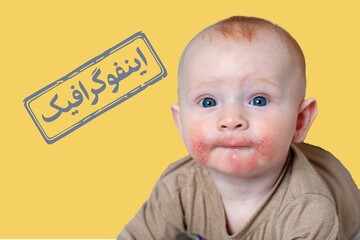 این خوراکی های حساسیت زا را به کودکان ندهید! + عکس