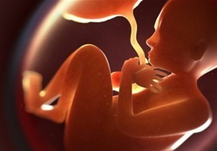 تصمیم شوکه کننده وزارت بهداشت برای توقف غربالگری جنین