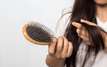 جلوگیری از ریزش مو با مصرف ریزمغذی‌ها