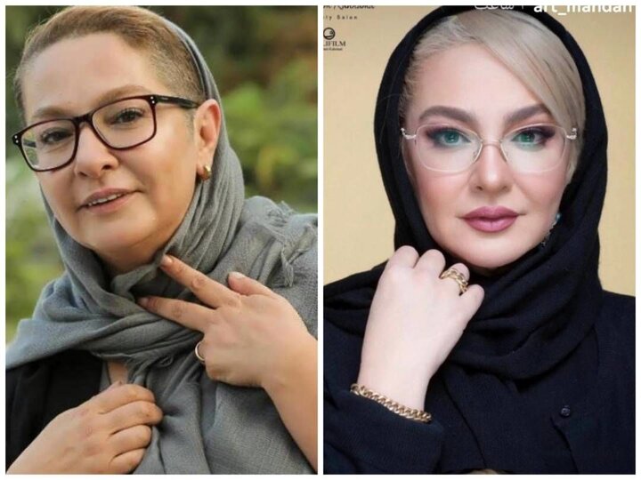 حمله وحشیانه کیف قاپ حرفه ای به بازیگر زن مشهور ایرانی | بستری شدن بازیگر زن در بیمارستان