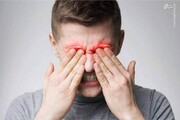 علت اصلی چشم درد چیست؟ + پیشگیری و درمان